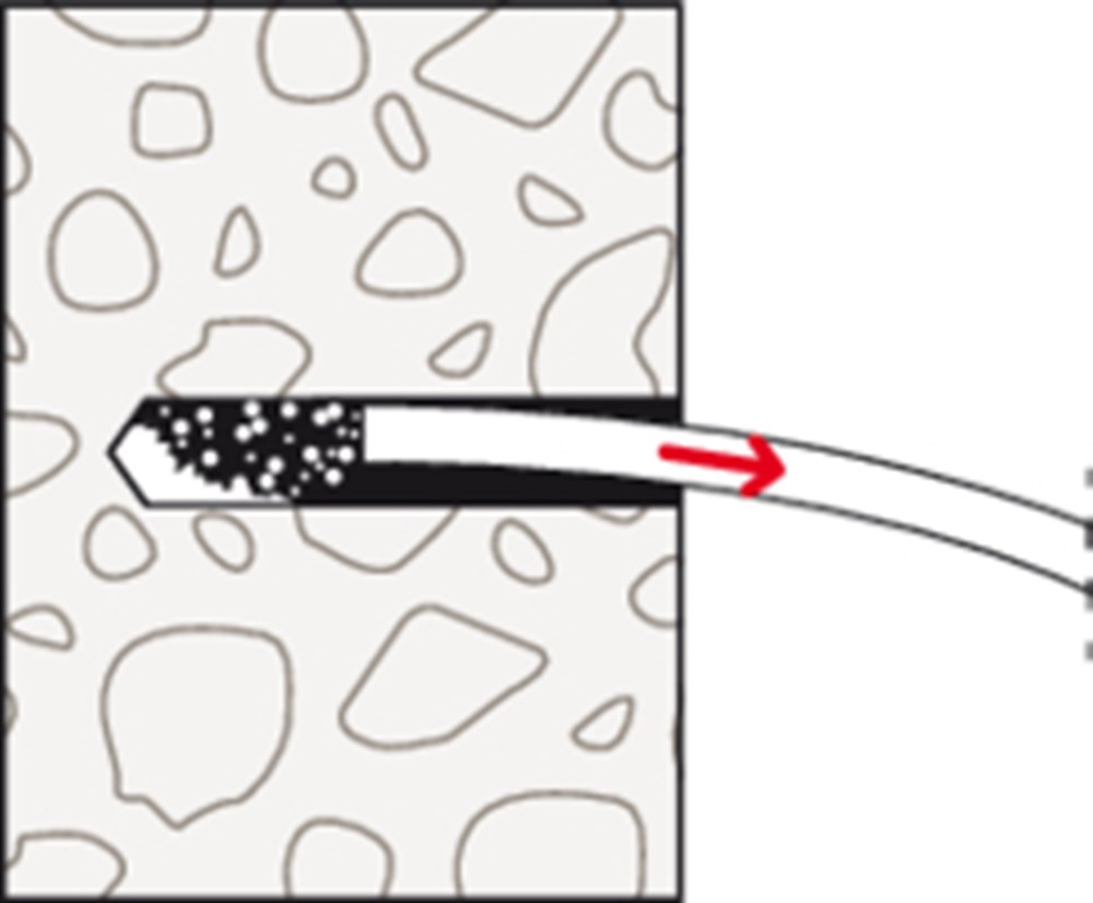 hulsanker elvz fischer-5 hulsanker elvz fischer-5